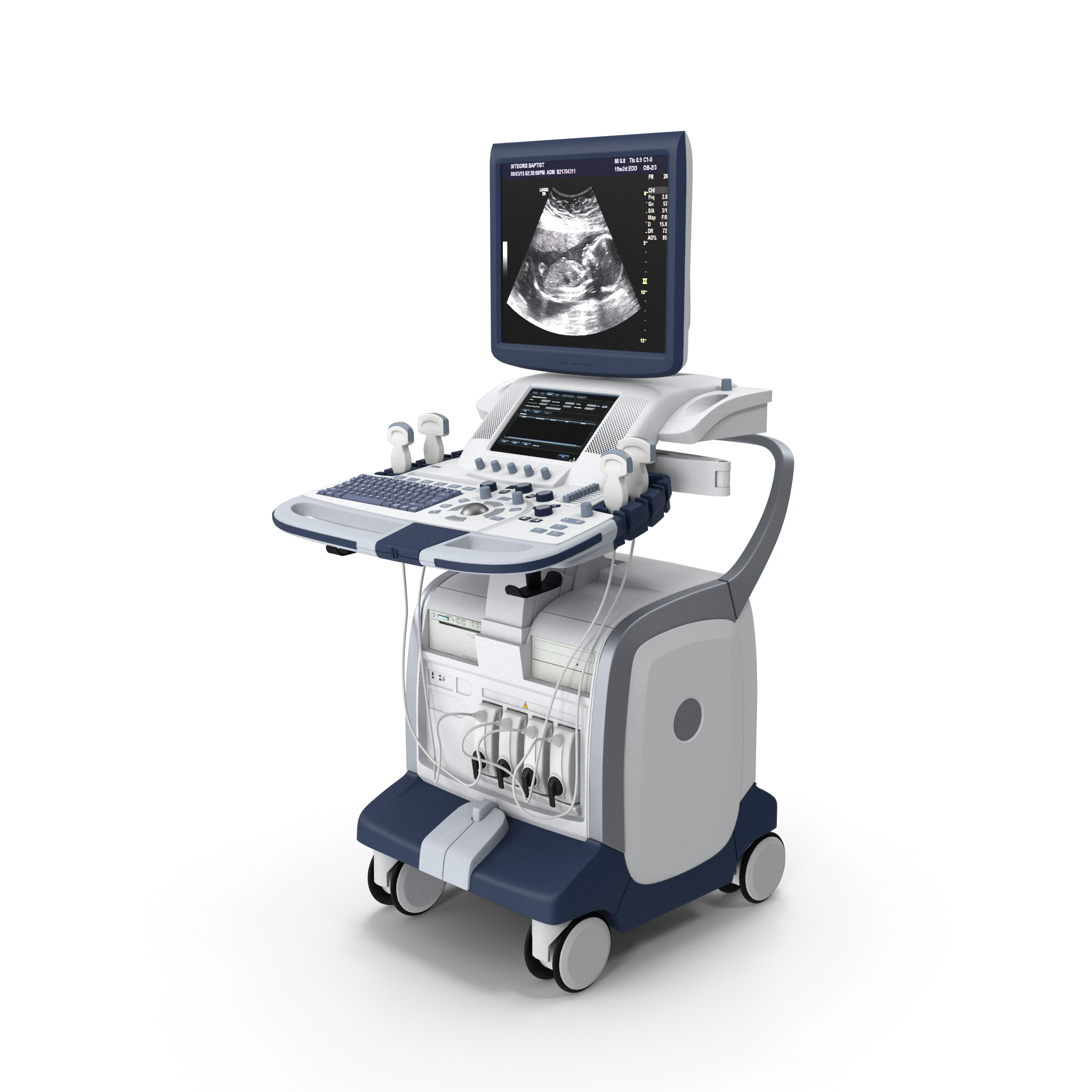 Doppler Ultrasound Machine